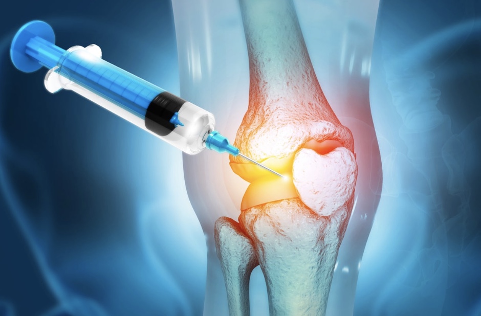 Corticosteroid Injections for Musculoskeletal&nbsp;Pain